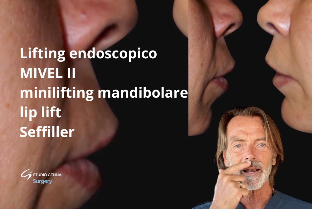 definizione linea mandibolare jawline