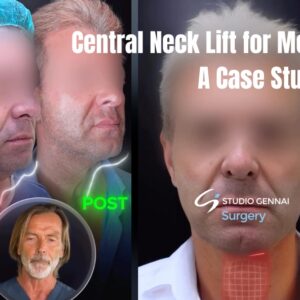 central neck lift for men
