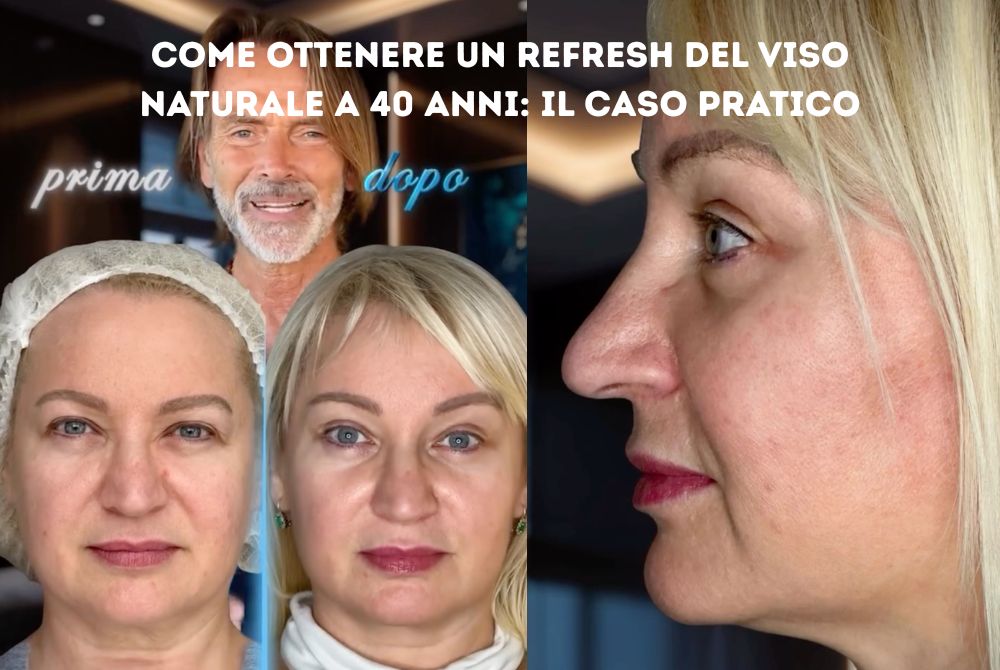 refresh viso naturale