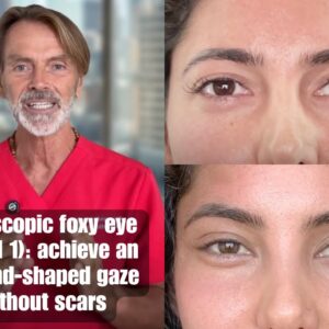 endoscopic foxy eye