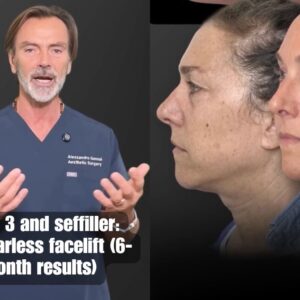 mivel 3 scarless facelift